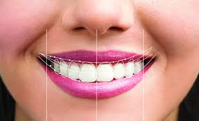 Best Smile Designing Treatment In Anand Nagar