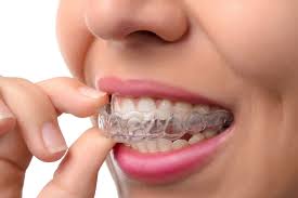 Root Canal Treatment in Gurugram Root Canal Treatment in Gurugram