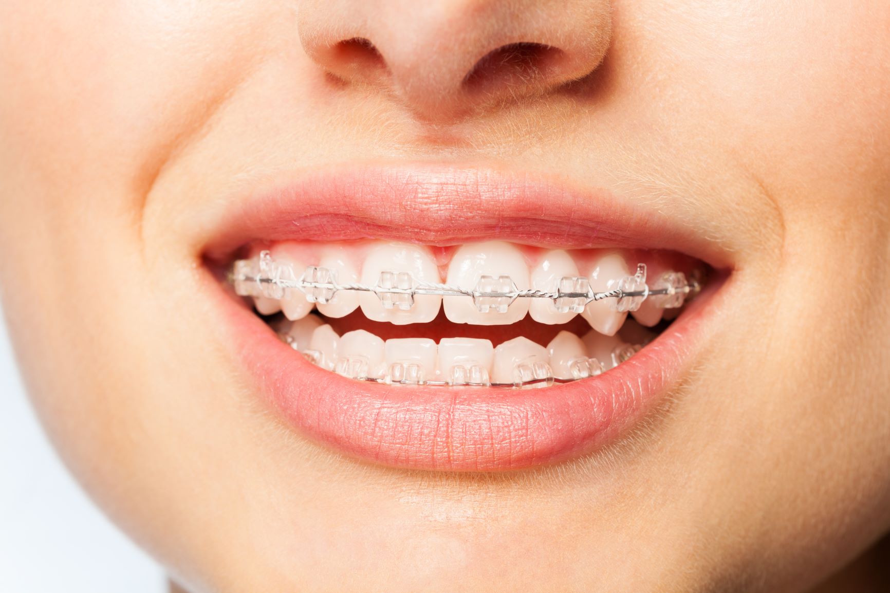 Root Canal Treatment in Gurugram Root Canal Treatment in Gurugram